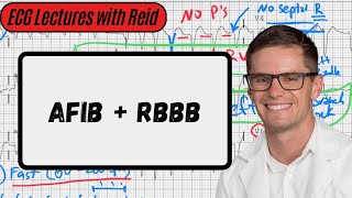 Atrial Fibrillation w Right Bundle Branch Block  Day 15 ECG Challenge [upl. by Crystal]