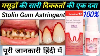 stolin gum astringent how to use  हिंदी में  stolin gum astringent how to use in hindi [upl. by Sel701]