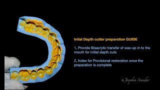 Veneer preparation GUIDE Initial Depth cutter [upl. by Atined]