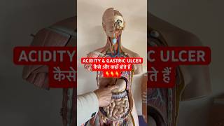 ACIDITY amp GASTRIC ULCER कैसे और कहाँ होते हैं  Digestive System viral shorts trending [upl. by Ramo]