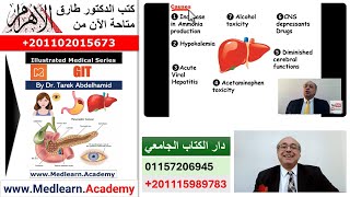 Acute Hepatic Coma internalmedicine cme medicaleducation ecg محاضراتباطنة medical [upl. by Bael679]