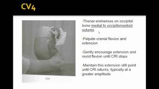 COMLEX Board Review OMT Vault Hold and CV4 [upl. by Fayth]