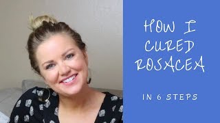 How I Cured Rosacea For Good  6 Steps [upl. by Eisdnyl]