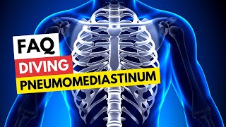 FAQ Diving amp Pneumomediastinum [upl. by Nodababus643]