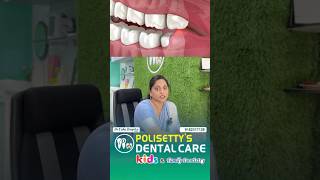 Wisdom Teeth Removal Safe Comfortable amp Expert Care at Polisetty’s Dental dentaltown [upl. by Lemraj]