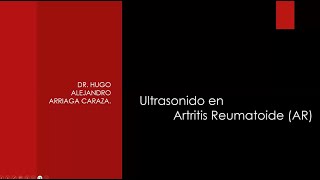 26 US en Artritis Reumatoide  Dr Arriaga [upl. by Delmor912]