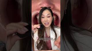 Do I have veneers veneers veneersmile smilemakeover dentist whiteteeth [upl. by Nels]