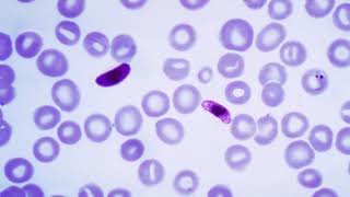 Plasmodium falciparum biology  Wikipedia audio article [upl. by Koralie]