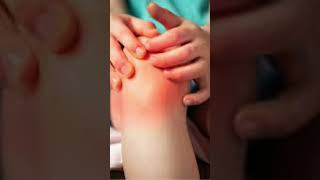 Juvenile idiopathic arthritis formerly known as juvenile rheumatoid arthritispeds ytshorts [upl. by Tenney]