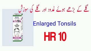 HR 10 Masood Homeopathic Medicine  Enlarged Tonsils  Tonsillitis  Throat Inflammation [upl. by Llednar626]