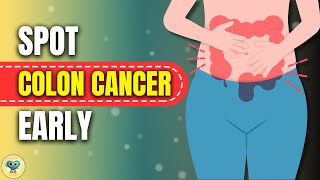 Colon Cancer Symptoms  Colorectal Cancer  10 warning signs of Colon Cancer  Colon Cancer [upl. by Machute]