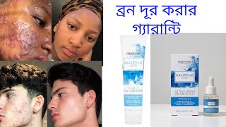 Creightons Salicylic Acid Intense Serum 2 Salicylic Bangla Review  The Pretty Touch  Rupchorcha [upl. by Nodlehs645]