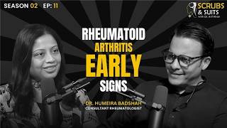 What You Need to Know About Rheumatoid Arthritis  Expert Advice and Treatment Options [upl. by Estrellita558]