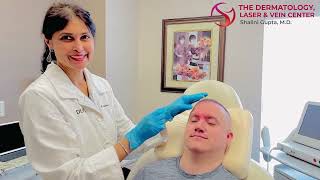 Treating Deep Frown Lines “Elevens” with Botox and Radiesse Filler  Dr Shalini Gupta [upl. by Annodas]