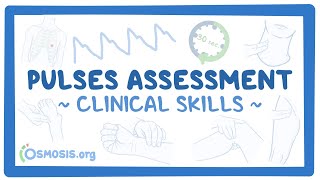 Clinical Skills Pulses assessment [upl. by Suoivatnod311]