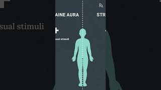 Migraine Aura or Stroke How to Tell the Difference [upl. by Siddra]