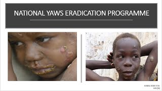 NATIONAL YAWS ERADICATION PROGRAMME [upl. by Rosco381]