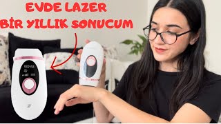 XIAOMI İNFACE İPL 1 YILLIK SONUCUM evdelazer [upl. by Jessamine340]