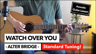 Watch Over You  Alter Bridge  Campfire Style Guitar Lesson in Standard Tuning [upl. by Lorry]