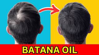 Stop Hair Loss with Batana Oil [upl. by Airekal]