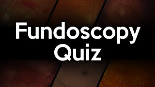 Fundoscopy Quiz [upl. by Nolubez110]