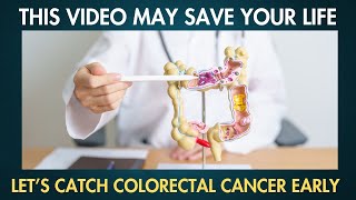 11 Early Signs of Colorectal Cancer that you SHOULDN’T IGNORE [upl. by Nonnairb]