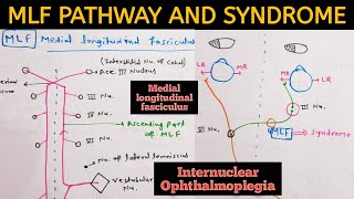 Medial Longitudinal FasciculusMLF  Pathway and MLF Syndrome  Internuclear ophthalmoplegia INO [upl. by Morgun363]