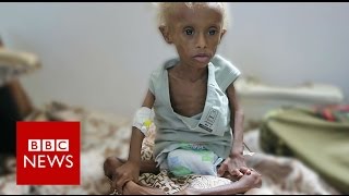 Yemen On the brink of starvation  BBC News [upl. by Aziul]