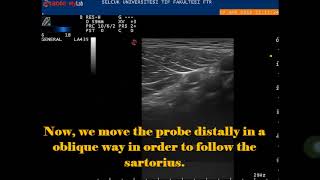 MUSCULOSKELETAL ULTRASOUND LOWER EXTREMITY MUSCLES Sartorius [upl. by Hedi]