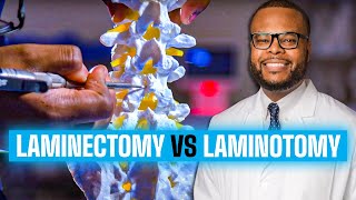 Laminectomy vs Laminotomy  Spinal Decompression Explained [upl. by Gannon]