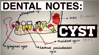 CYST  INTRODUCTION  DEFINITION  CLASSIFICATION [upl. by Ditmore]