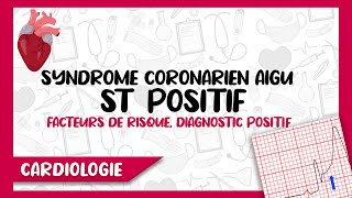 Syndrome Coronarien Aigu Segment ST Positif  Diagnostic Positif Symptomes amp ECG Complications [upl. by Deutsch]