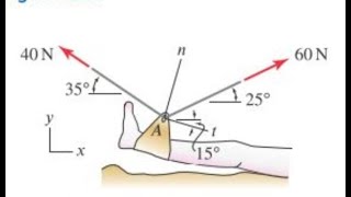 Traction is a medical procedure used to treat muscle and skeletat disorders by statics [upl. by Nierman]