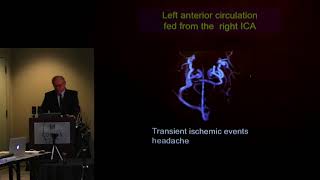 quotHeadache Differential in the Chiari and Hypermobility Spectrum Patientquot  Fraser C Henderson MD [upl. by Yelnet169]