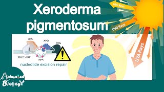 Xeroderma pigmentosum  What is the main cause of xeroderma pigmentosum  treatment of XP  USMLE [upl. by Anoblav]