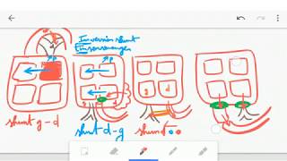 🔴 ASTUCE CARDIOPATHIES CONGENITALES   DR ASTUCE [upl. by Beuthel]