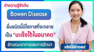 Bowen Disease ผื่นที่มีโอกาสทำให้เกิดมะเร็งได้ [upl. by Ehtyde274]