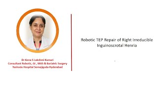 Robotic TEP Repair of Right Irreducible Inguinoscrotal Hernia [upl. by Judus]