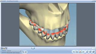 Dental Occlusion [upl. by Navis252]