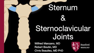 Sternum and Sternoclavicular Joints  Wilfred Manzano MD [upl. by Enomsed]