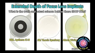 CataractCoach™ 1954 EDOF IOLs Extended Depth of Focus Lens Implants [upl. by Alleris]