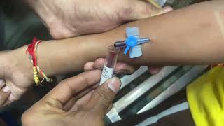 Intravenous Cannulation  iv cannula fixing  blood collection using by cannula  iv vigo [upl. by Habas216]