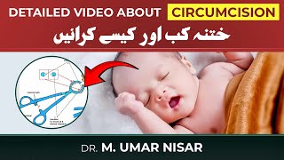 Detail video about Circumcision in Children  When and How to do it [upl. by Ueihttam241]