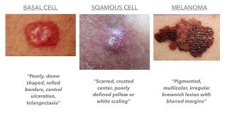 Dermatology on USMLECOMLEX [upl. by Dionysus]