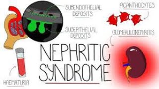 Nephritic Syndrome  Causes  Symptoms  Types  Treatment [upl. by Ytsihc]