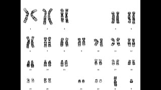 Karyotyping Human chromosome identificationeasiest way of making KaryogramCytogenetic analysis [upl. by Jauch]