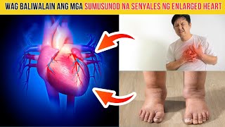 TOP 5 SINTOMAS ng ENLARGED HEART [upl. by Nadabb779]