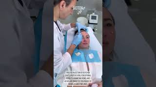 Botox Injection Preparation and Precision Placement for Wrinkle Treatment [upl. by Haleeuqa]