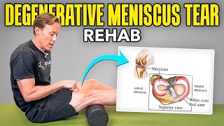 4 Rehab Exercises for a Degenerative Meniscus Tear [upl. by Oralla]