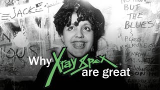 Why XRAY SPEX are great [upl. by Cade]